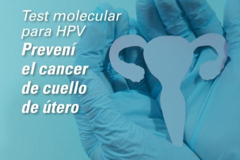 TEST MOLECULAR DE HPV